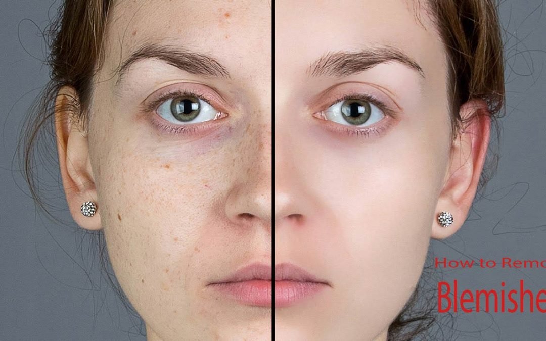 How to remove blemishes in photoshop